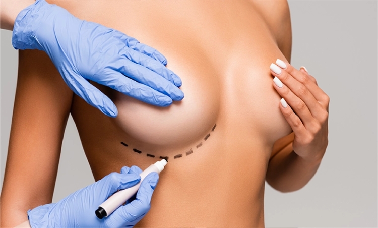 Breast Lift in Dubai: What Sets the Best Doctors Apart