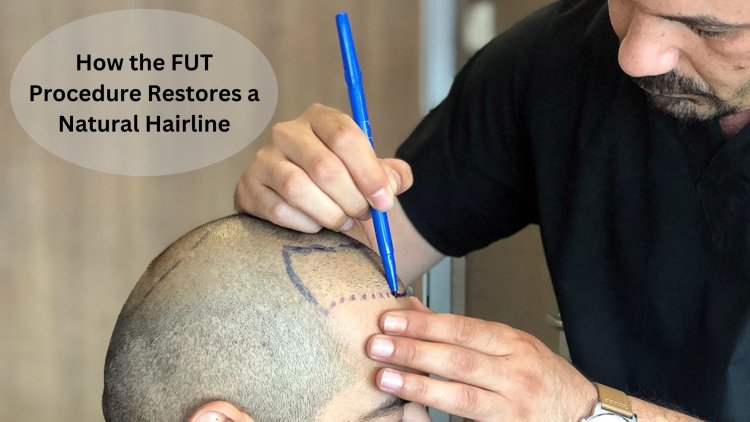 How the FUT Procedure Restores a Natural Hairline