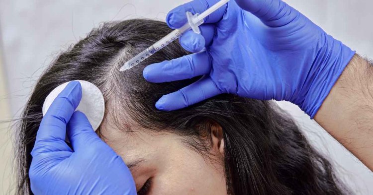 Best Dermatologist of Hair Loss in Guwahati: Get the Safest and Most Effective Treatment of Hair | Essence Skin Care