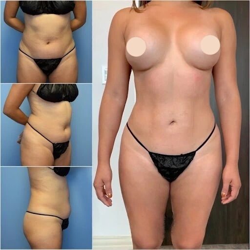 Best Doctors in Dubai for Body Contouring: Enhancing Your Curves and Confidence